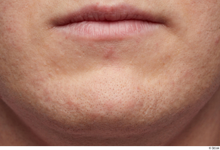 HD Faec Skin Doe Irish chin face lips mouth skin…
